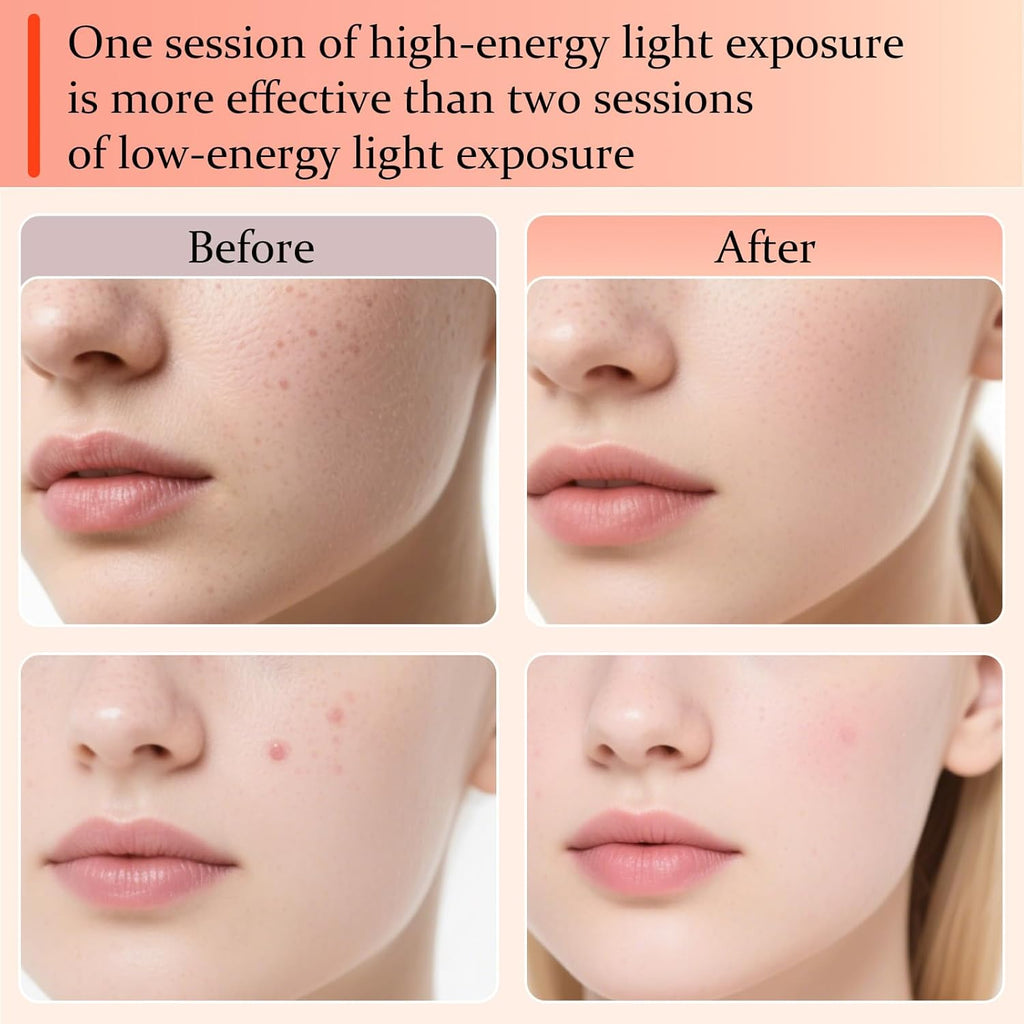 LED Light Therapy Mask Australia – 7 Color Face Treatment for Acne & Wrinkles